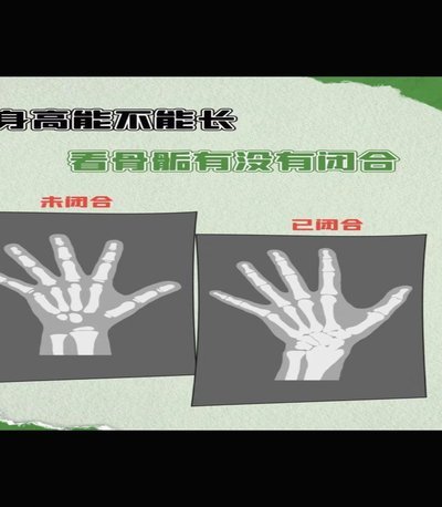 赵松源一定要控制身高，不能在长高了